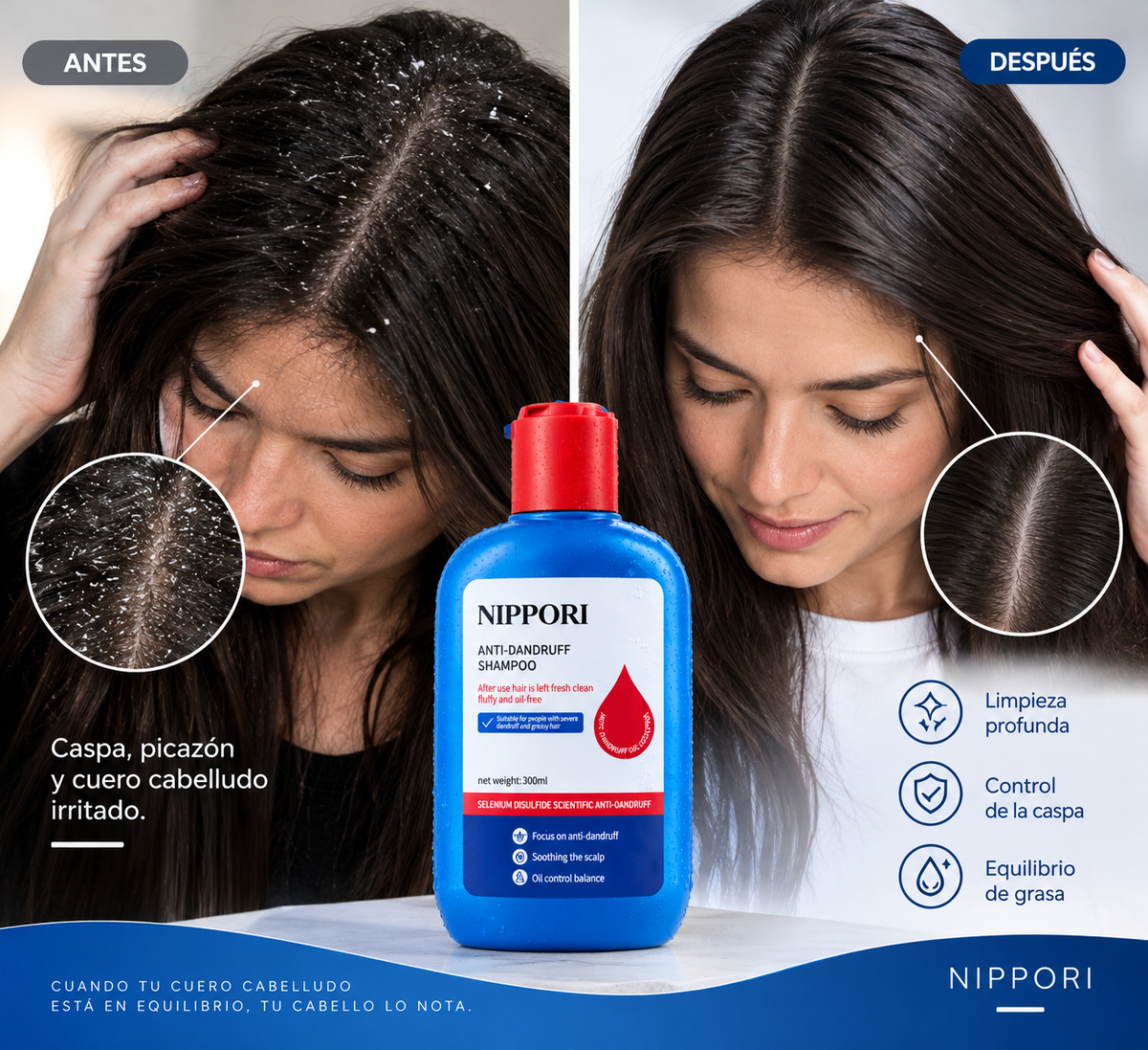 SHAMPOO NIPPORI ANTICASPA